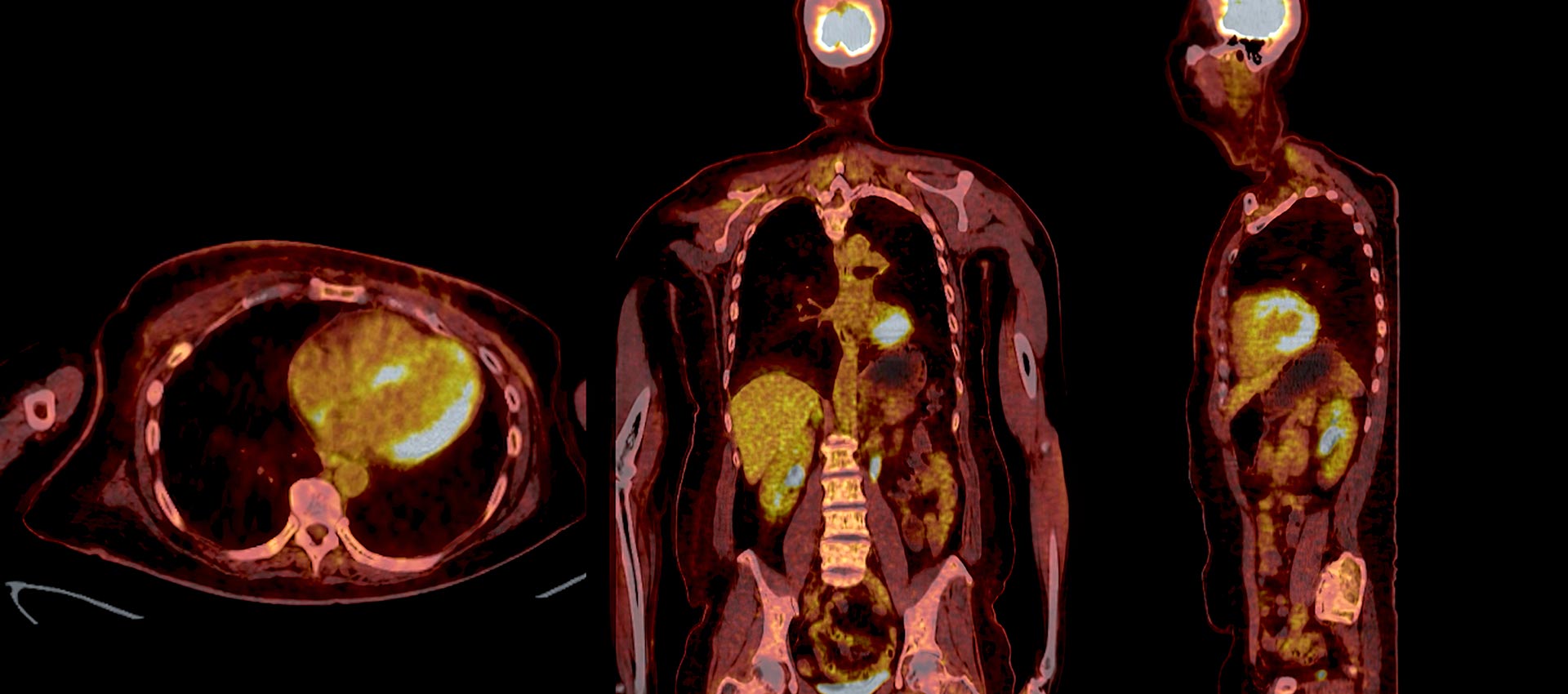 Nuclear Medicine/PET Imaging